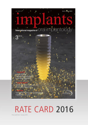 Cover Rate card implants MD Implants 2016 en/2016