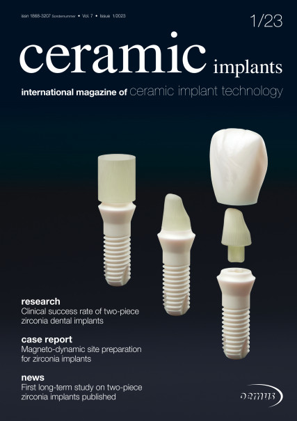 Publication Image for ceramic implants
