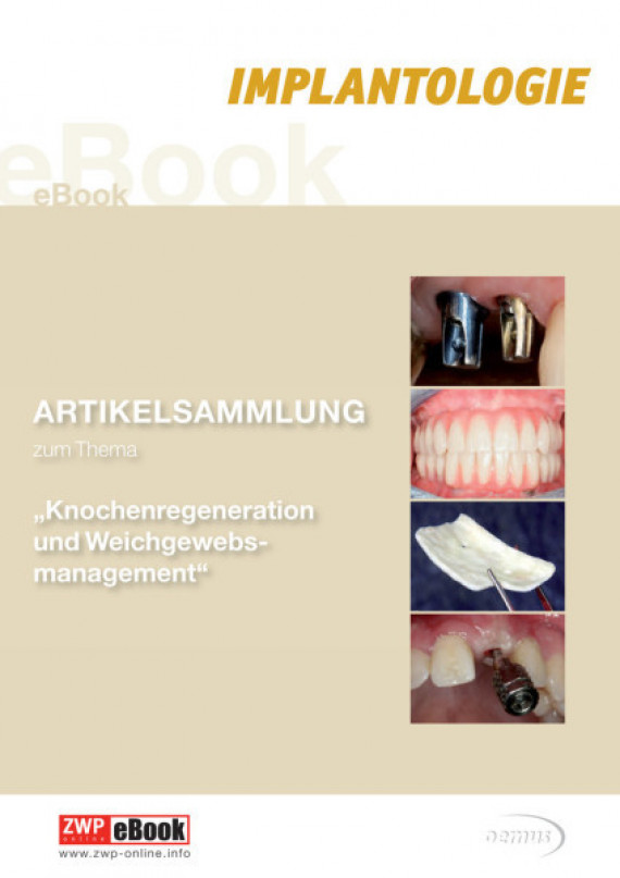eBook Knochenregeneration Knochenregeneration/2015