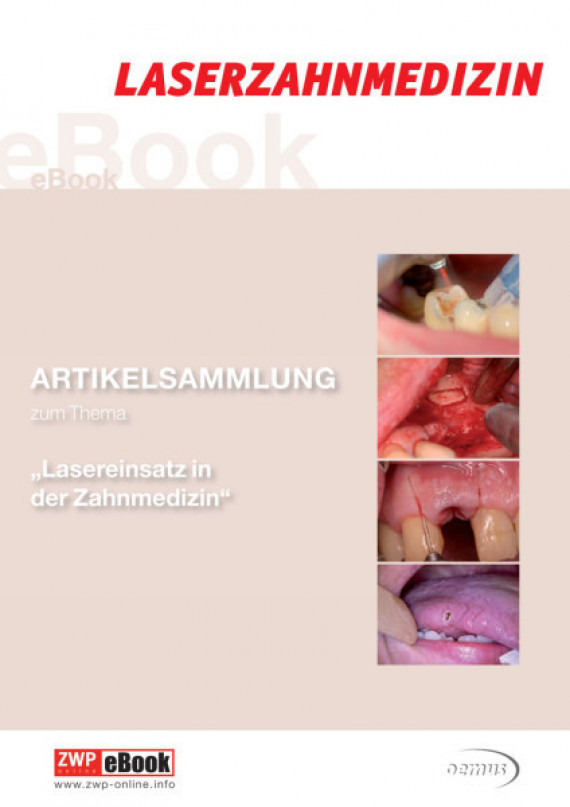 eBook Laserzahnmedizin Laserzahnmedizin/2015