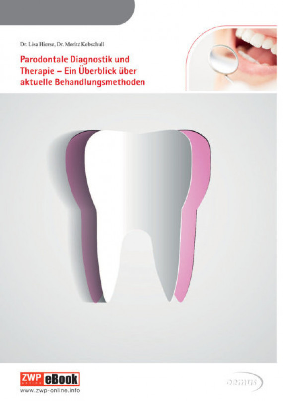 eBook Parodontale Diagnostik und Therapie ParodontaleDiagnostik/2015