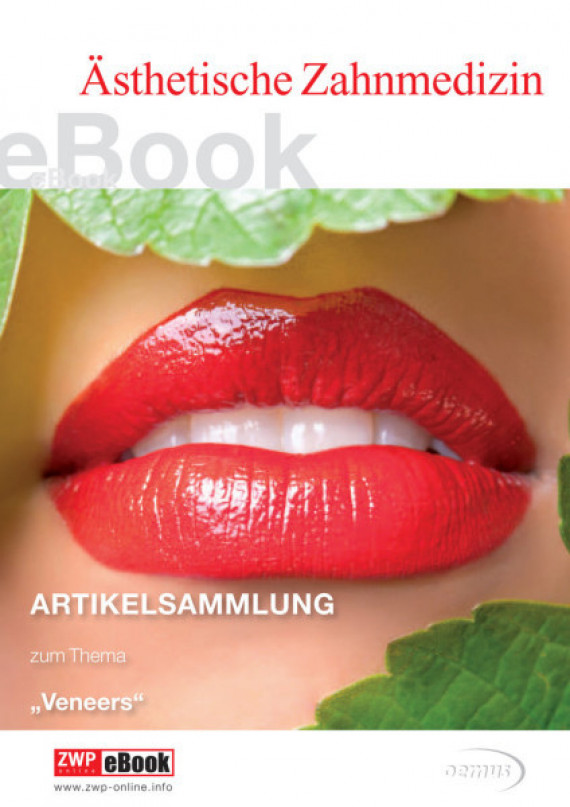 eBook Veneers Veneers/2015