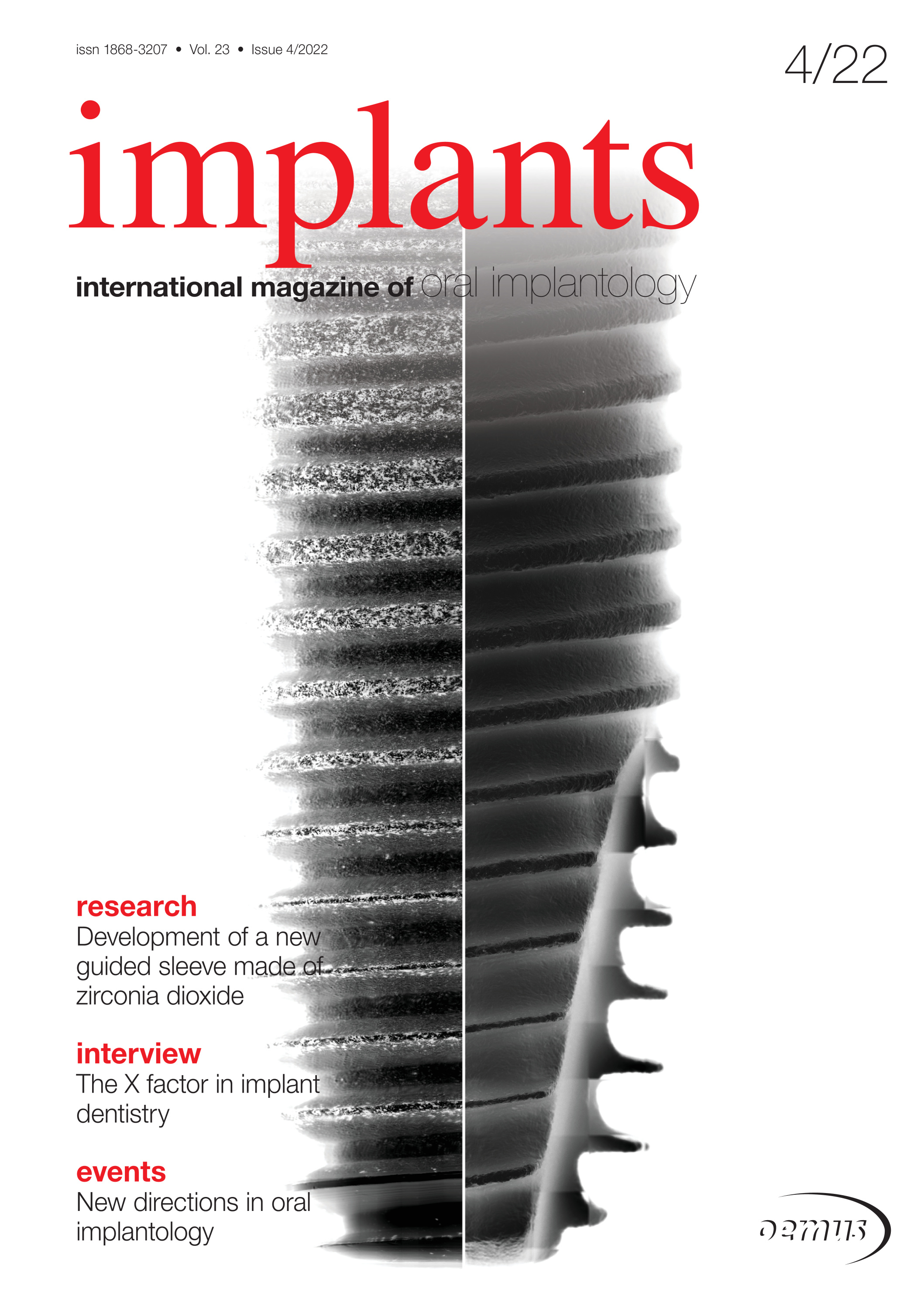 cover zu Implants 04/2022