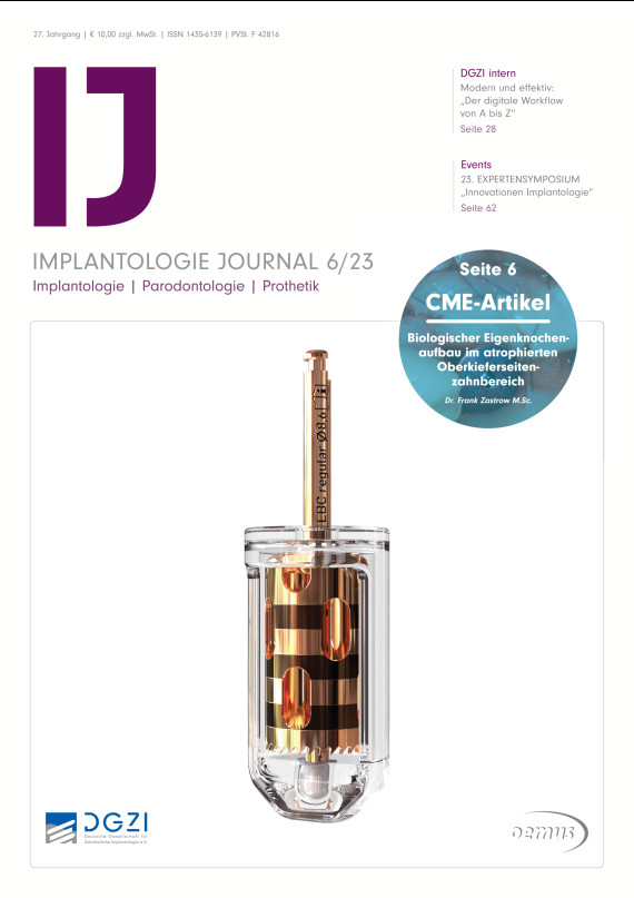 cover zu Implantologie Journal 06/2023