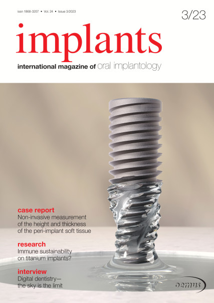 Publication Image for Implants