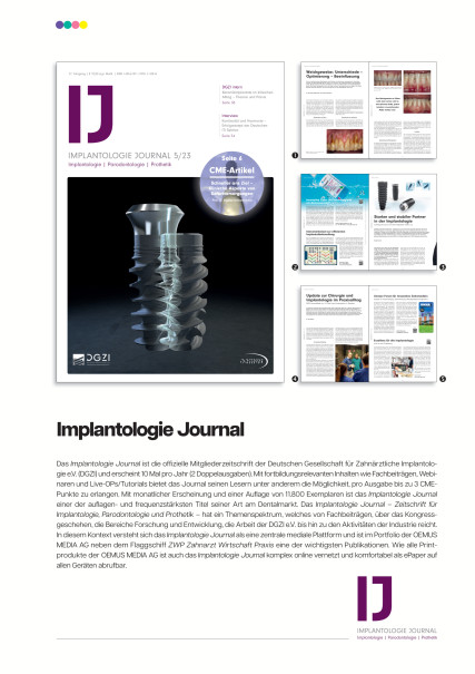 Publication Image for Mediadaten Implantologie Journal
