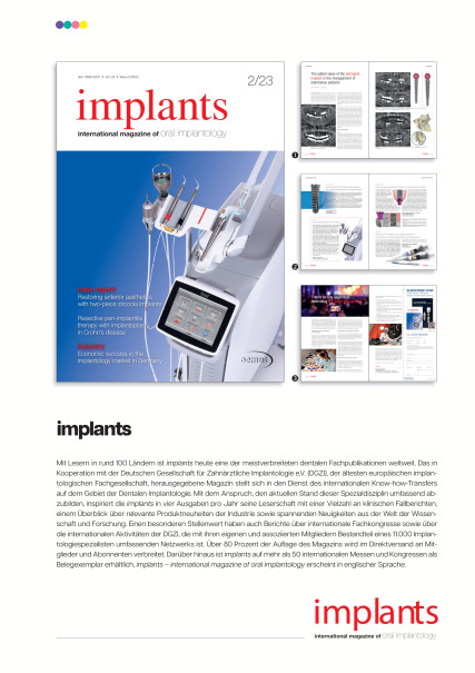 Publication Image for Mediadaten implants