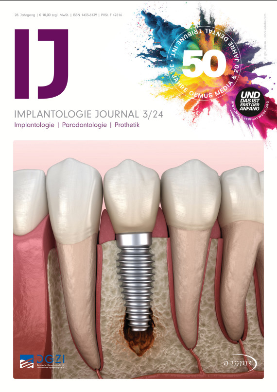 cover zu Implantologie Journal 03/2024