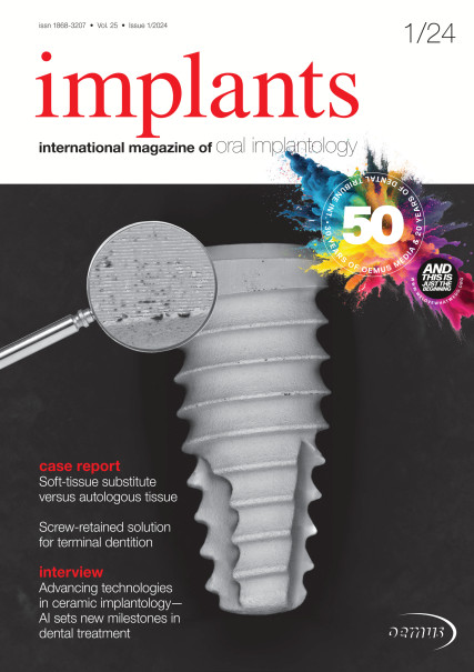 Publication Image for Implants