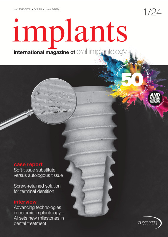 cover zu Implants 01/2024