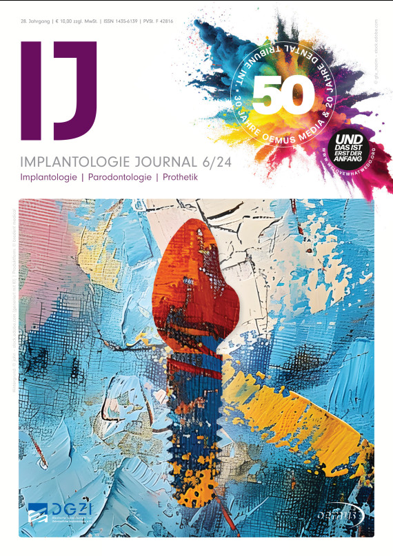 cover zu Implantologie Journal 06/2024
