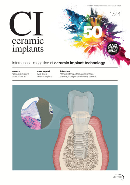 Publication Image for ceramic implants