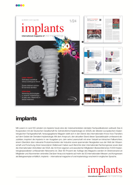 Cover bild gehörig zu Mediadaten implants