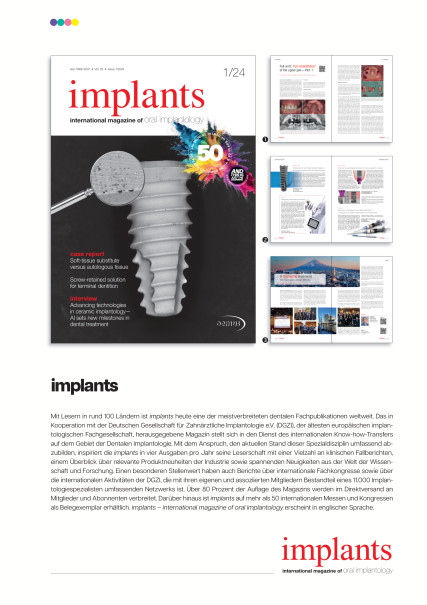 Publication Image for Mediadaten implants