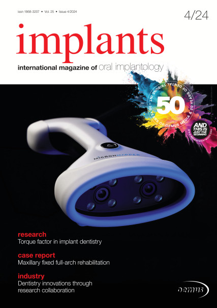 Publication Image for Implants