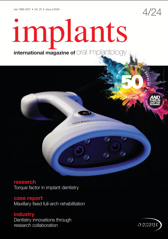 cover zu Implants 04/2024