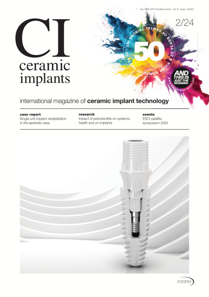 Publication Image for ceramic implants