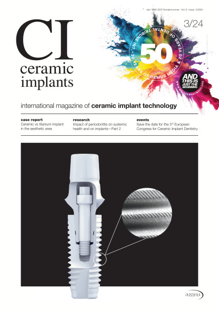 Publication Image for ceramic implants