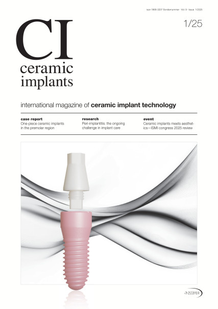 Publication Image for ceramic implants