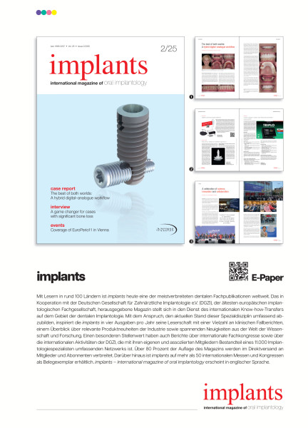 Cover bild gehörig zu Mediadaten implants