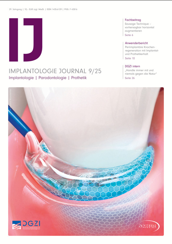 Cover Implantologie Journal 09/2025