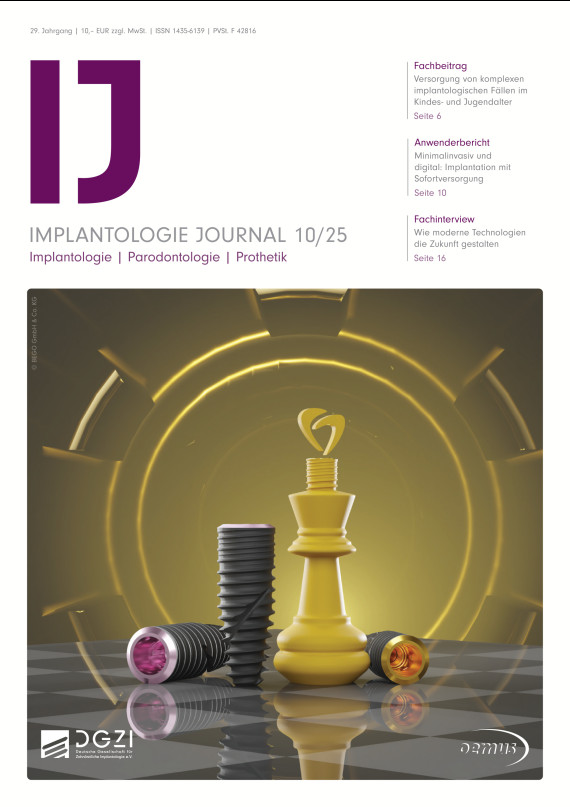 cover zu Implantologie Journal 10/2025