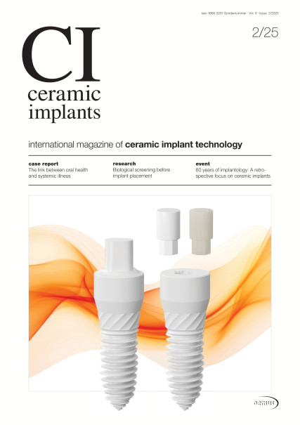 Publication Image for ceramic implants