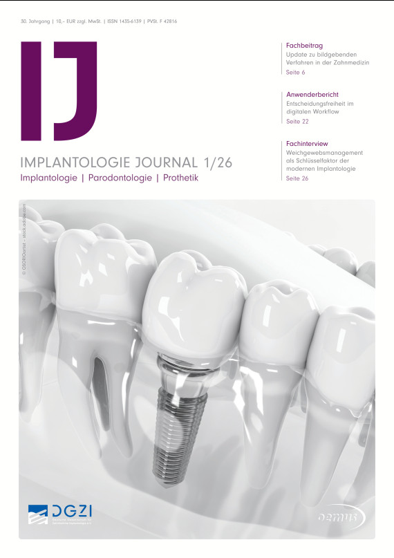 cover zu Implantologie Journal 01/2026