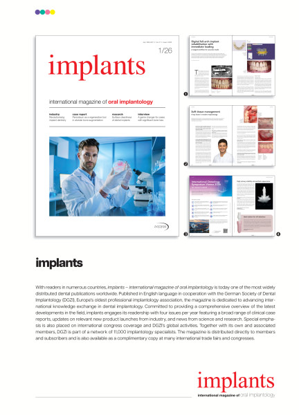 Cover bild gehörig zu Rate card implants