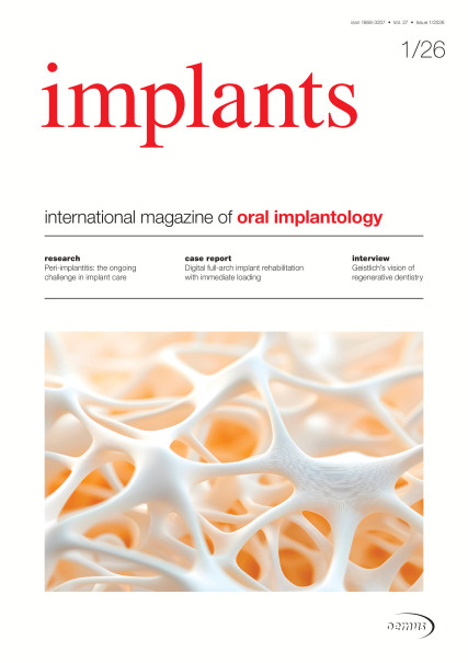 Publication Image for Implants