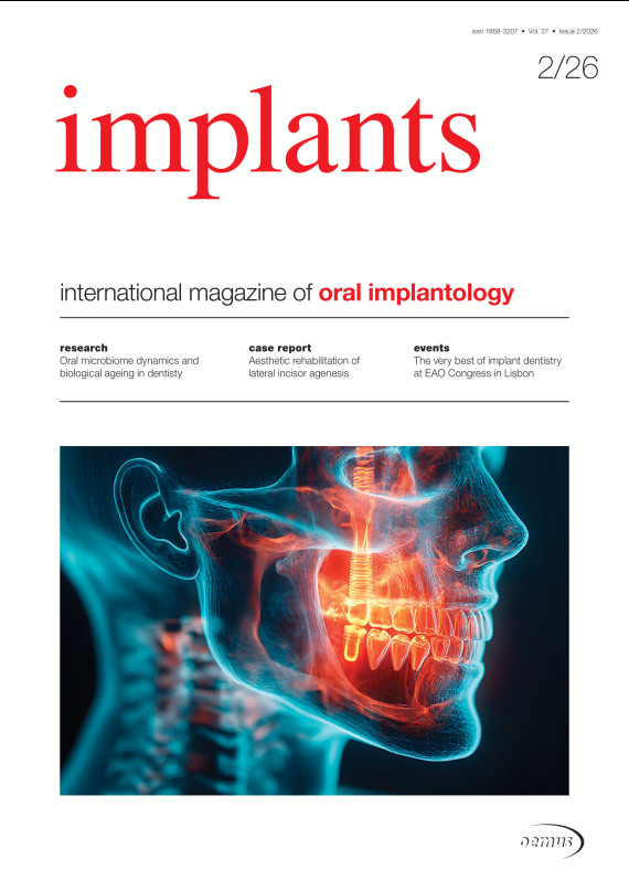 Cover Implants 02/2026