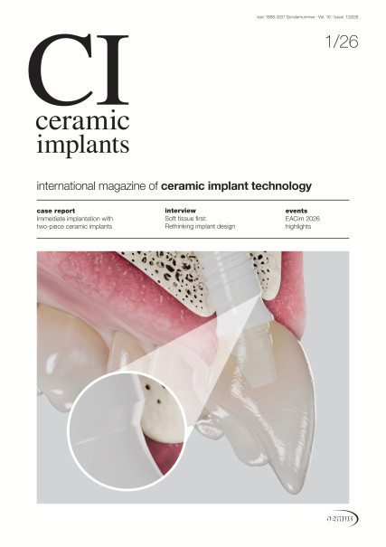 Publication Image for ceramic implants